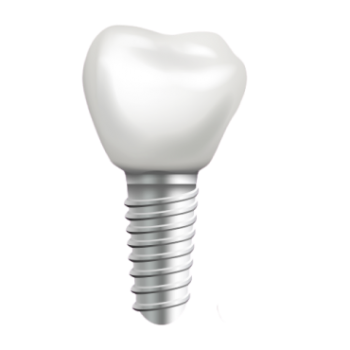 Имплантация зубов