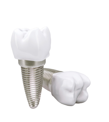 Классическая двухэтапная имплантация