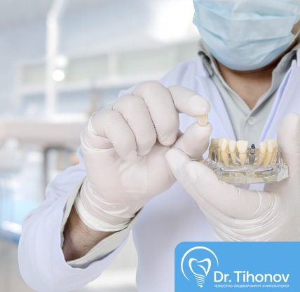 Есть ли преимущества у двухэтапной имплантации